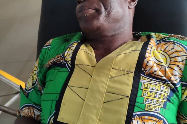 BREAKING: Gunmen Shoot Ebem Ohafia Devt Union Chairman, Ebere Okoro (Photos)
