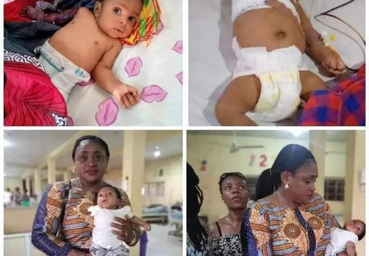 2-month-old baby’s arm amputated in Imo after angry father allegedly beat him for disturbing his sleep [PHOTOS]