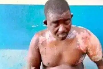 Newly wedded wife bathes her husband with hot water for stopping her from calling men