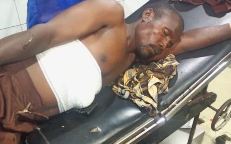 Abuja Herbalist In Critical Condition After Testing ‘Bulletproof’ Charm By Shooting Himself